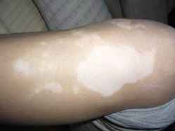 �ļ�ҽԺ���ư����